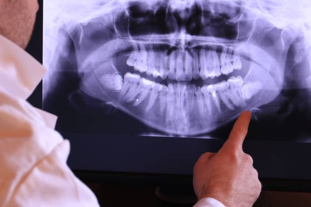 Best Same-Day Emergency Dental Services in Fuquay Varina, NC