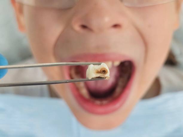 Best Pediatric Emergency Dentist in Fuquay Varina, NC